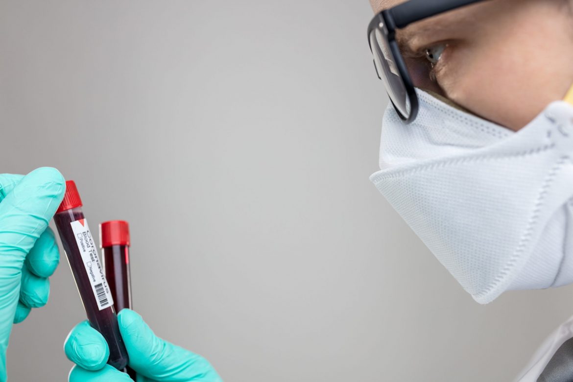 coronavirus-medic-analize-scaled